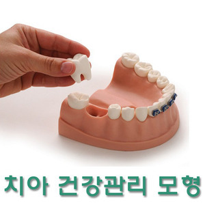 [Health Edco] 치아 관리모형 79229 (본체+썩은어금니+인조플라그 등) Dental Health Model