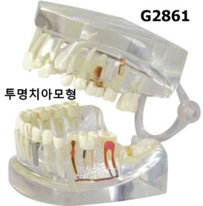 [GPI] 투명치아모형 G2861 실제사이즈