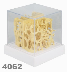 [독일Zimmer] 골다공증 비교모형 4062 골다공증모형 Osteoporotic bone structure comparison model.