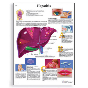 [3B] 간염차트 VR1435L(코팅),VR1435UU(비코팅) Hepatitis Chart (Size 50x67cm)