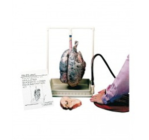 [독일Zimmer] 흡연자 폐모형 R10061 (시연용,실물규격) Smokers Lung Model