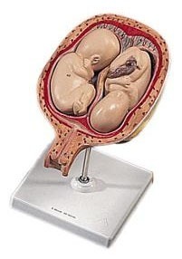 [3B] 5개월 쌍둥이 태아모형 L10/7 (5Th Month Twin Fetuses,normal position)