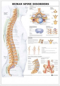 3D해부도(벽걸이)/9970B/척추질환차트,척추차트/Human Spine Disorders/ Size 54cmx74cm