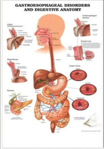 3D해부도(벽걸이)/9965/위식도질병차트,소화기차트/Gastroesophageal Disorders &amp; Digestive System/ Size 54cmx74cm