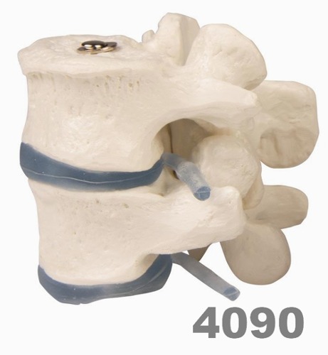 [독일Zimmer] 요추모형 4090 (실제규격,2개set,분리관찰) 2 lumbar vertebrae.