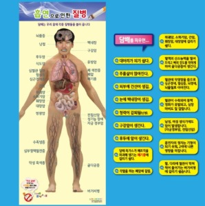 [HEC] 흡연에 의한 질병② kim3-836 (족자형,500*1180mm,질병자석17종)