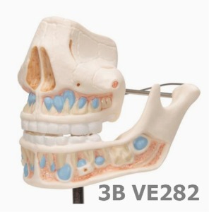 [3B Scientific] 어린이 치열 모형 VE282 (13*12813cm,0.4Kg) Milk Dentures