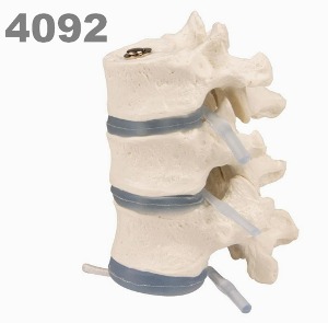 [독일Zimmer] 흉추 모형 4092 (실제규격,3개set,분리관찰) 3 thoracic vertebrae.