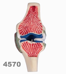 [독일Zimmer] 세로단면 무릎 모형 4570 (Longitudinal section-model knee).