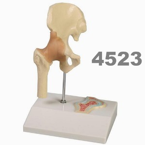[독일Zimmer] 고관절 모형 4523 (1/2실제규격,인대포함) Miniature Hip Joint with cross section.