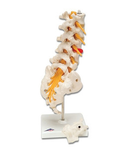 [3B] 요추모형 A76/5 (Lumbar Spinal Column with dorso) 추간판 탈출증 디스크모형 (34cm)