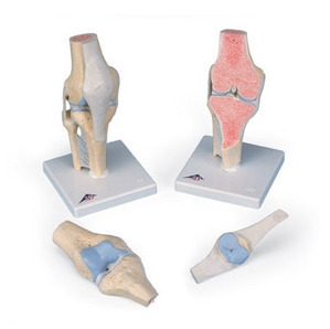[3B] 3분리 무릎관절 모형 A89 (Sectional knee joint model,3-part)