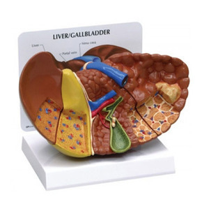 [GPI] 간질환모형 G331 (Diseased Liver 331) 간모형