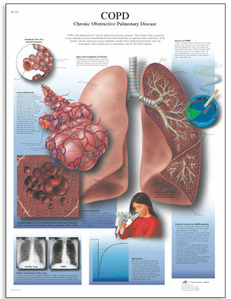 [3B] 폐질환차트 COPD차트 VR1329UU(비코팅) Chronic Obstructive Pulmonary Disease (Size 50x67cm)