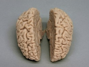 [독일Zimmer] 뇌 표준모형 C710 (실물규격) Human Brain,actual cast