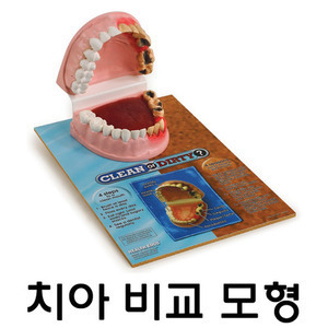 [Health Edco] 치아비교모형 79650