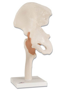 [3B] 고관절모형 A81 (Functional Hip Joint)