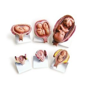[HEC] 태아발달모형 6단계 KIM-M0007-2,kim3-509 임신태아모형