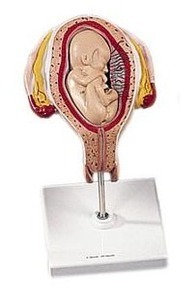 [3B] 5개월 둔위태아 L10/5 (5th Month Fetus, breech position)