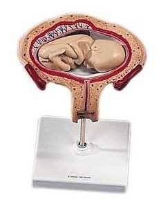 [3B] 4개월 태아모형 L10/4 (4th Month Fetus,transverse lie)