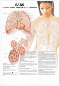 3D해부도(벽걸이)/9784/중증급성 호흡기증후군,호흡장애차트,사스차트/SARS/ Size 54cmx74cm