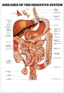 3D해부도 소화기질병차트 9861 (벽걸이)  소화기차트 Diseases of The Digestive (Size 54cmx74cm)
