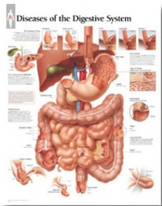 평면해부도(벽걸이)/1552/소화기관차트,소화기관 질병차트/Diseases of the Digestive System/Size 54cm*74cm